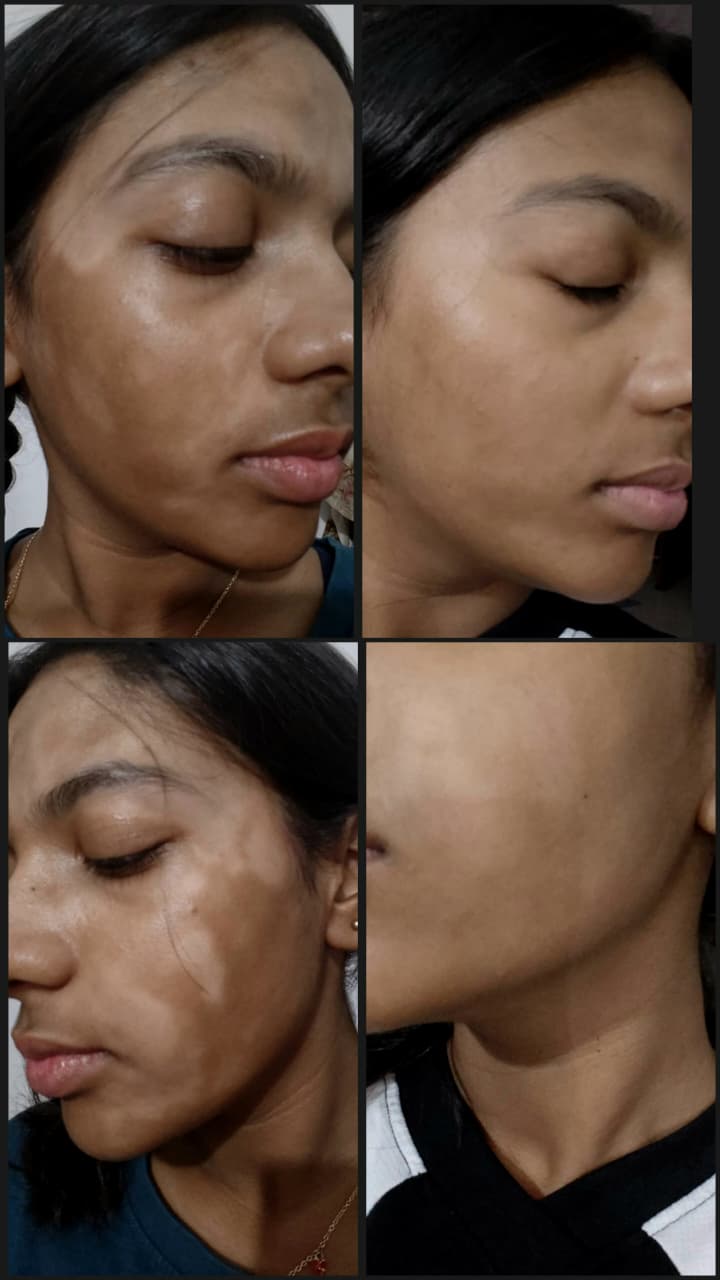 Significant improvement after homeopathic treatment